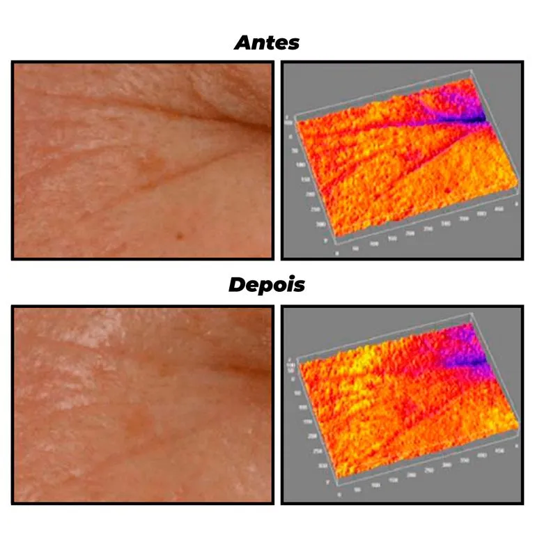 Ácido Retinol - Image 5